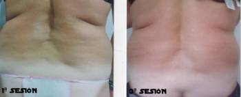 EPSON MFP image