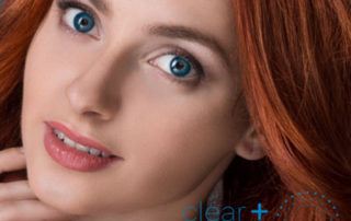 Tratamiento Clear + Brillian en Madrid