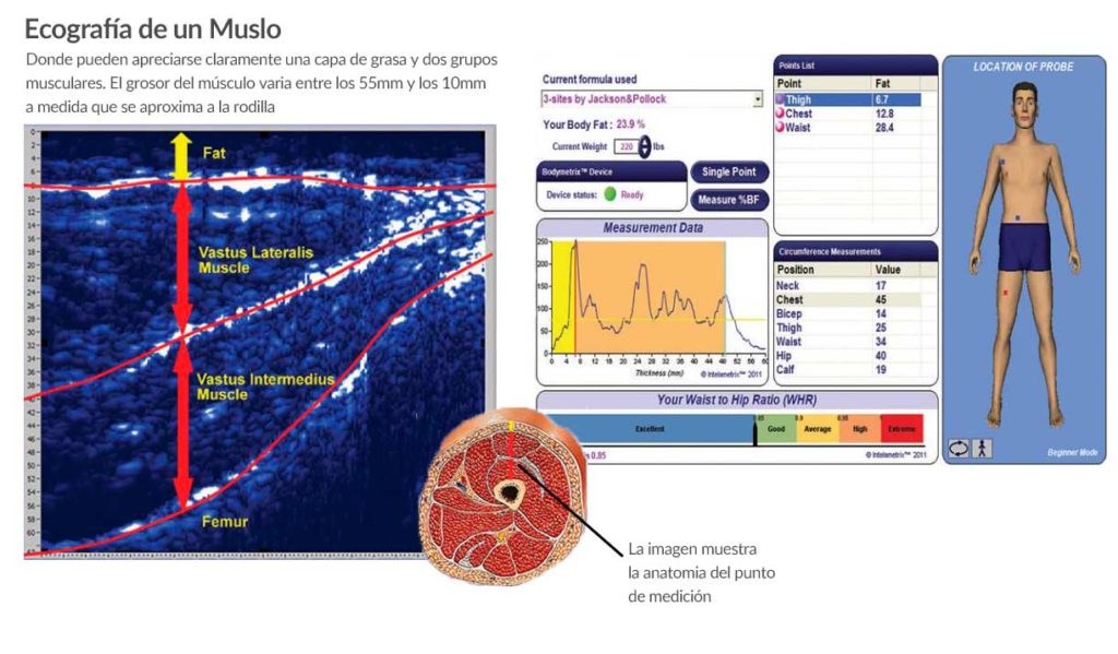 Diagnóstico corporal con medición ecografica en Madrid