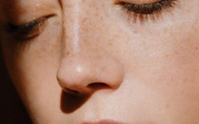 Tratamientos para las manchas en la cara: ¿Cuáles son los más efectivos?