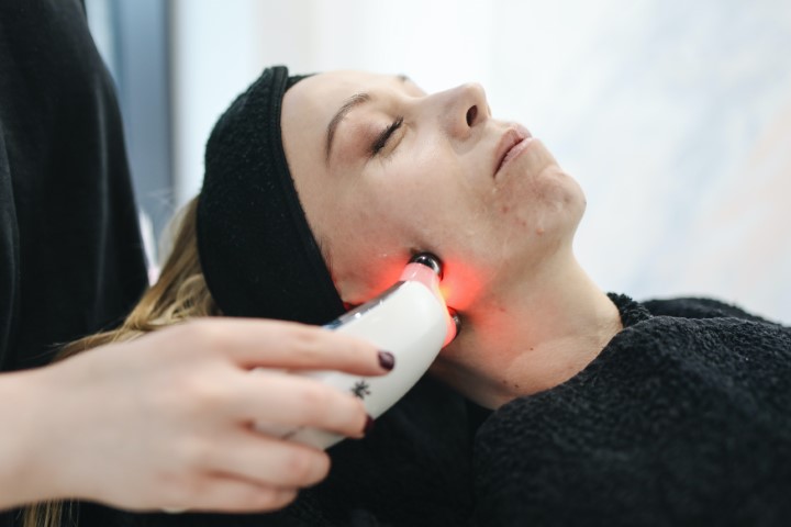 Mujer realizándose tratamiento láser para eliminar manchas en Madrid