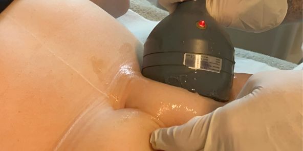 Tratamiento de cavitación corporal en Todo en Belleza con Cuca Miquel Mujer recibiendo tratamiento de cavitación en abdomen en centro de estética profesional.